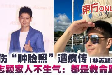 【林志穎車禍】受傷「腫臉照」遭瘋傳 林志穎家人:不會生氣