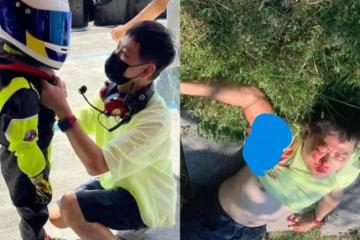 林志穎真是禍不單行，還未甦醒就遭索賠，面部重創可能要整容