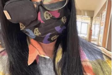 50歲視後失業一年 身體患病眼睛一高一低