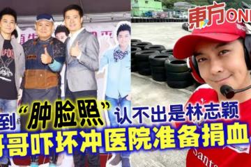 看到「腫臉照」認不出是林志穎　哥哥嚇壞沖醫院準備捐血