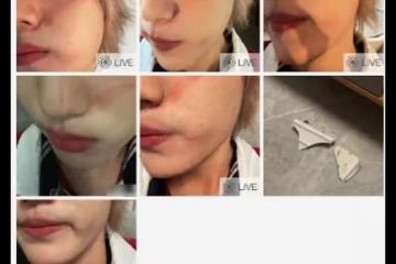 25歲男星被指控打人!直接拿碗砸向好友,受害者臉上傷痕令人後怕