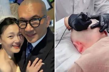 大S老公具俊曄去紋「頭髮」畫面曝光，一針一針紋在頭上，看著就疼