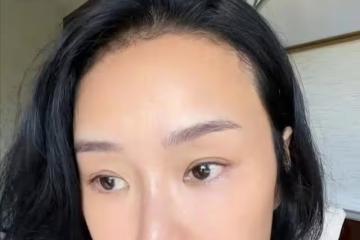 百萬網紅April:患癌症四期5年內存活率僅兩成,多處感染需切除