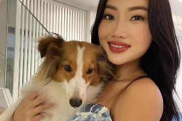 熱門港姐割完巨型腫瘤後參賽 肚子上留下一道疤