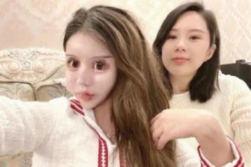 花費近百萬,網紅女孩3年整容60次,前後判若兩人,如今怎樣了?