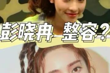出道多年長相瘋狂變化,從醜小鴨變成白天鵝,她才是整容如換臉!