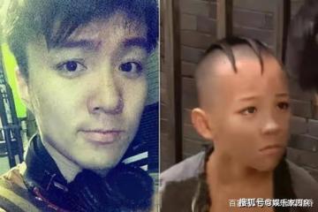 他憑「三毛」一夜爆紅，因謝頂縫合300多針，33歲容貌大變無人識