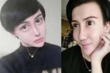 還記得整容失敗成「蛇精臉」的劉梓晨嗎？如今成功逆襲，顏值不輸楊穎