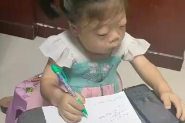 四歲女孩酷似趙忠祥，被曝光後遭全網惡意嘲諷，孩子只是生病了！